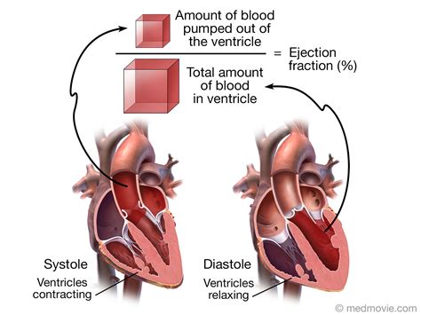 Ejection fraction